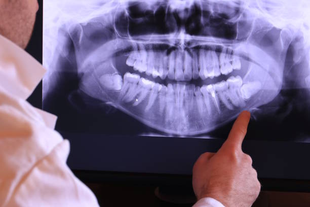Best Pediatric Emergency Dentist in Young Harris, GA